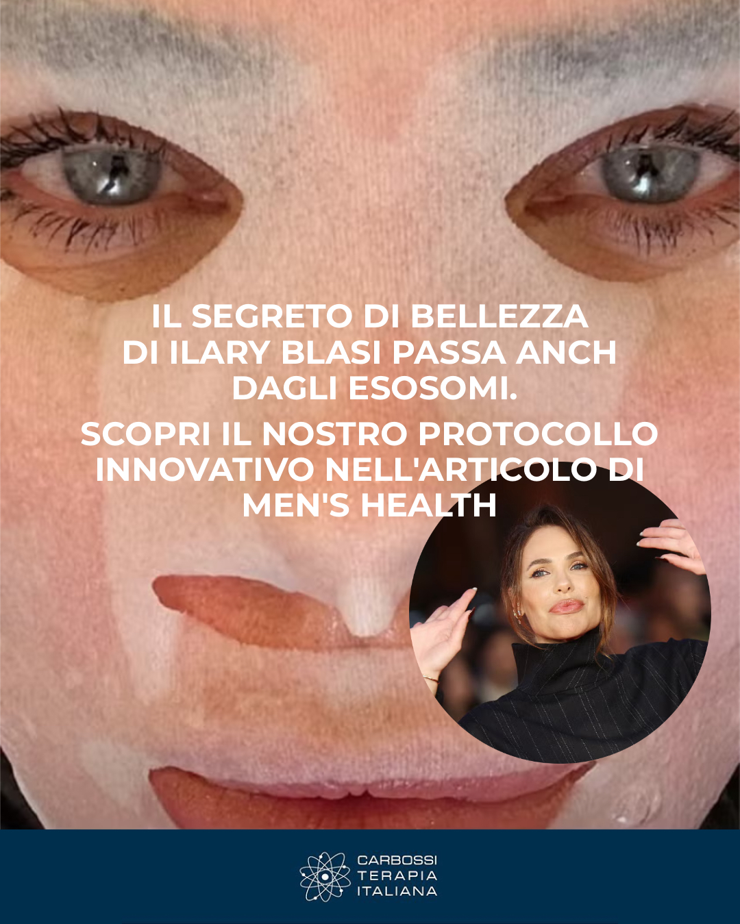 🌟 Il segreto di bellezza di Ilary Blasi? Gli esosomi. 🌟Su Men’s Health si parla di un protocollo innovativo sperimentato anche dallo Studio Medico Adigrat, che unisce tre pilastri della medicina estetica:✔️ Carbossiterapia per stimolare microcircolazione e ossigenazione✔️ Needling medicale per aprire micro-canali nella pelle✔️ Esosomi – i “messaggeri di giovinezza” – per rigenerare i tessuti, stimolare collagene e donare nuova compattezzaUn approccio multi-step che trasforma la pelle: più luminosa, levigata e uniforme già dopo poche sedute.✨ Con Carbossiterapia Italiana puoi scoprire questa straordinaria combinazione grazie a:🔹 gli esosomi Olimet e Giakut🔹 la nostra CDT Light per la carbossiterapia🔹 il microneedling Raffine📖 Leggi l’articolo completo su Men’s Health 👉 LINK IN BIO📩 Contattaci per scoprire come integrare anche tu questa combo rivoluzionaria nei tuoi trattamenti.#Carbossiterapia #Esosomi #Needling #Rigenerazione #CDTLight #Olimet #Giakut #Raffine #CarbossiterapiaItaliana #MensHealth #StudioMedicoAdigrat