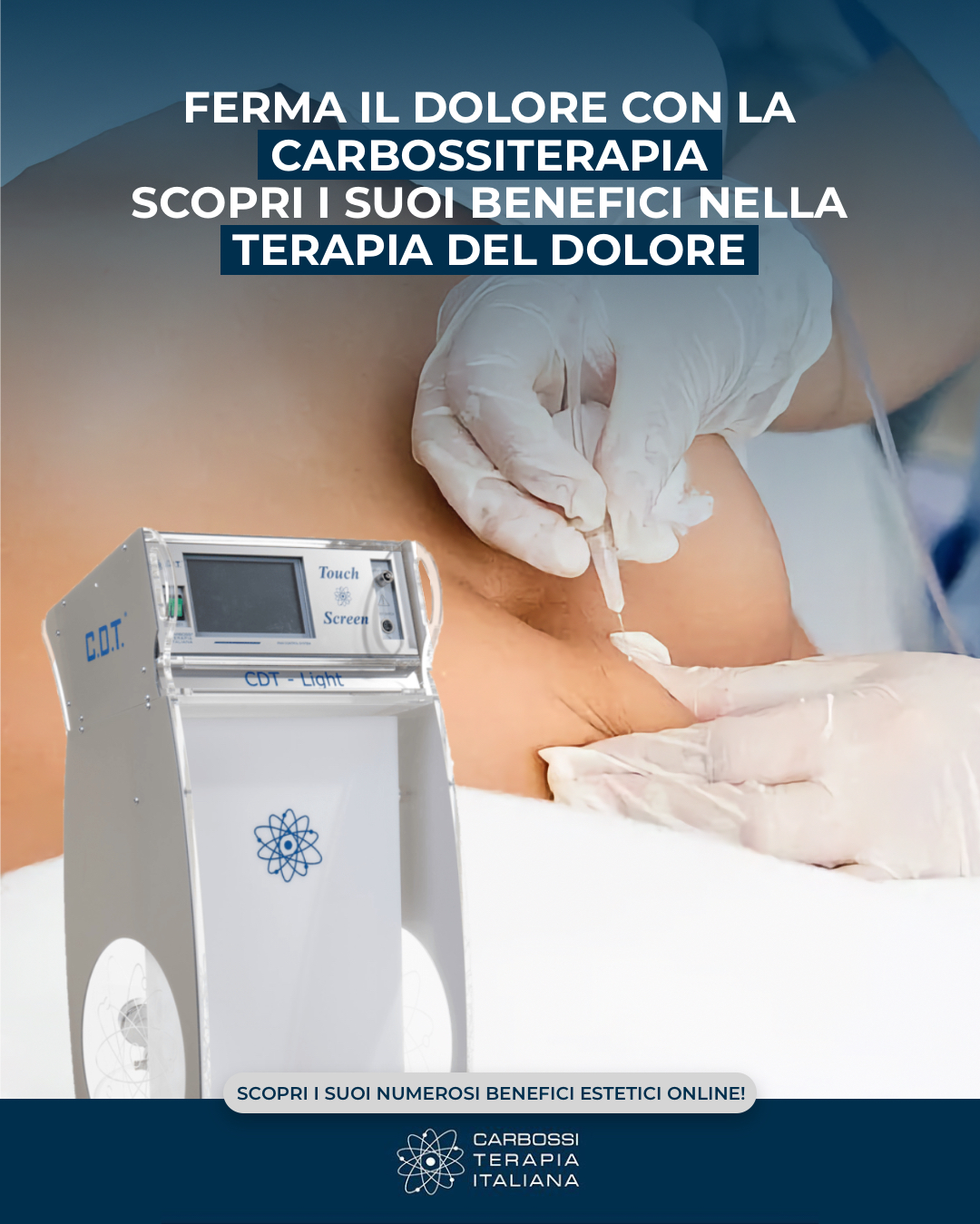 💨 Stop al dolore con la CarbossiterapiaUn trattamento medico sicuro e naturale che, grazie alla CO₂, migliora la circolazione e dona sollievo da:👉 mal di schiena e cervicale👉 epicondilite👉 tunnel carpale👉 tendiniti e dolori articolari⚡ Effetto analgesico rapido, poche sedute e nessun effetto collaterale.✨ Una soluzione efficace per i dolori acuti e cronici!Scopri di più sulle tanti applicazioni d’uso della carbossiterapia nel nostro sito web 👉 https://carbossiterapia.it/applicazioni-e-soluzioni/#CarbossiterapiaItaliana#Carbossiterapia #DoloreCronico #DoloreAcuto #Benessere #Salute