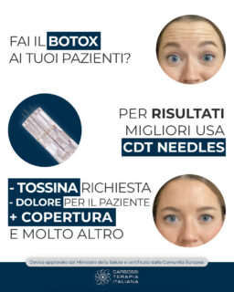 Grazie a #CDTNeedle è possibile utilizzare fino all’85% in meno di #tossinabotulinica per ottenere LO STESSO RISULTATO, risultando tra l’altro in meno fastidi per il paziente e una seduta più rapida!

Particolarmente interessante per esempio nella cura della #iperidrosi, in cui è richiesto un numero maggiore di inienzioni!

Questo è solo uno dei tantissimi campi di applicazione dei CDT Needle: contattaci per maggiori informazioni!
#CarbossiterapiaItaliana #Botox