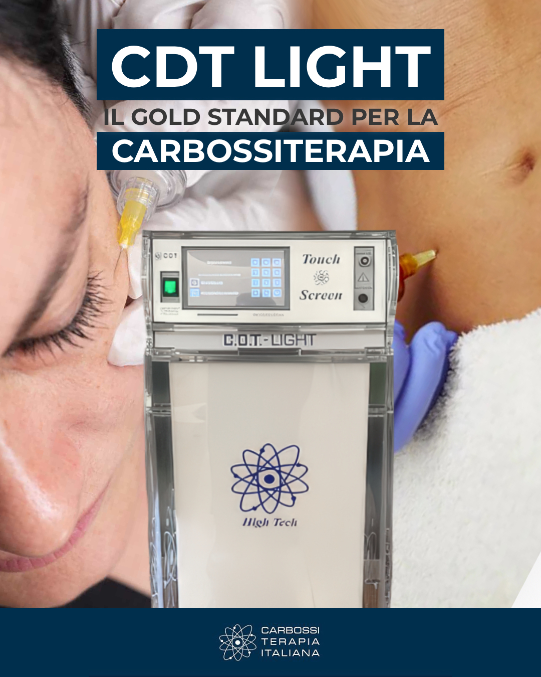 ✨ Scopri il potere della carbossiterapia con CDT Light! ✨Con CDT Light di Carbossiterapia Italiana, porti nel tuo studio un sistema all'avanguardia, progettato per rigenerare i tessuti, migliorare la microcircolazione e stimolare collagene ed elastina, per risultati visibili su pelle, corpo e cicatrici.💡 Perché sceglierlo?• Dispositivo medico certificato MDR (MHRA / Allegato II UE), conforme ai più elevati standard di sicurezza e qualità.• Tecnologia regolabile e versatile: ideale per trattamenti estetici viso e corpo, nonché per drenaggio, ossigenazione e ringiovanimento.• Trattamenti non invasivi e personalizzabili, perfetti per chi cerca risultati naturali e duraturi.Prenota una consulenza e scopri come CDT Light può trasformare il tuo approccio alla bellezza e al benessere. 🌿#CarbossiterapiaItaliana #Carbossiterapia #CDTLight #SkinRevival #BeautyTech #MedicinaEstetica #GlowUp #WellnessCenter
