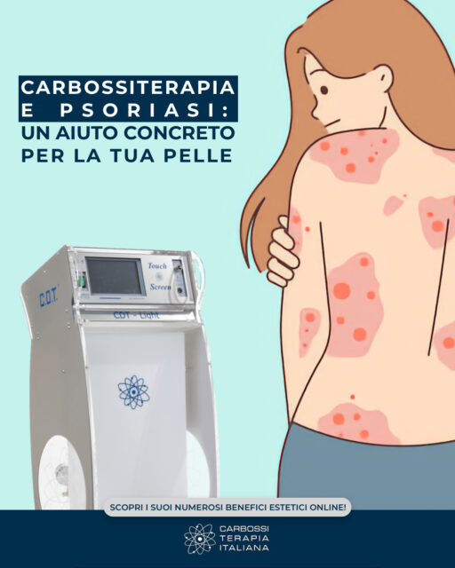 ✨ Carbossiterapia e Psoriasi: un aiuto concreto per la pelle ✨La carbossiterapia non è solo un trattamento estetico, ma un vero alleato per chi soffre di psoriasi.Grazie all’azione del CO₂ medicale, migliora la microcircolazione, favorisce l’ossigenazione dei tessuti e stimola i meccanismi di rigenerazione cellulare.Il risultato? Una pelle più idratata, meno infiammata e con riduzione visibile delle lesioni.Un approccio naturale e non invasivo che aiuta la pelle a ritrovare equilibrio e benessere. 🌿#Carbossiterapia #Psoriasi #MedicinaEstetica #CDTLight #RigenerazioneCutanea #BenessereDellaPelle #Dermoaroma #CarbossiterapiaItalianaVuoi che lo adatti per una specifica pagina (es. Carbossiterapia Italiana, Dermoaroma o un centro medico)? Così posso calibrare tono e hashtag.
