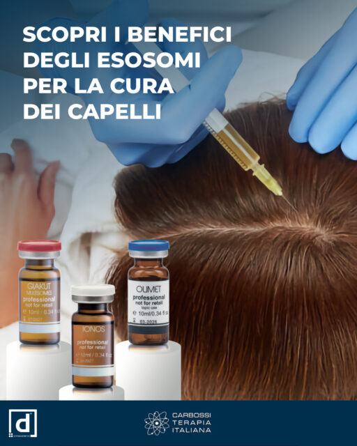 ✨ Esosomi e caduta dei capelli: perché se ne parla così tanto?Gli esosomi (micro-vescicole “messaggere” rilasciate dalle cellule) stanno emergendo come possibile opzione rigenerativa per alcuni tipi di diradamento, grazie a proprietà rigenerative e immunomodulanti. ￼🔬 Cosa potrebbero fare a livello del follicolo (in parole semplici):• Riattivare le cellule staminali del follicolo, favorendo l’ingresso nella fase di crescita (anagen) ￼• Supportare la micro-circolazione (angiogenesi), migliorando apporto di nutrienti al bulbo ￼• Ridurre l’infiammazione locale e modulare la risposta immunitaria del cuoio capelluto ￼• Veicolare proteine, fattori di crescita e microRNA coinvolti nei segnali di crescita e vitalità follicolare ￼✅ Per chi può essere interessante (valutazione sempre medica):• Alopecia androgenetica (maschile/femminile) ￼• Alopecia areata (a chiazze, componente autoimmune) ￼• Chi cerca un approccio non chirurgico o non ha ottenuto risultati soddisfacenti con terapie convenzionali ￼🧪 Nel protocollo descritto, gli esosomi sono estratti da cellule staminali mesenchimali, e sottoposti a controlli di sterilità e sicurezza (incluse verifiche endotossine), poi somministrati secondo indicazione dello specialista. ￼Scopri di più sulla nostra linea di prodotti a base di esosomi Dermagenetic nel nostro sito👉 https://carbossiterapia.it/esosomi-e-multiesosomi/#CarbossiterapiaItaliana#Dermagenetic #GiakutMultisomes #CuraCapelli #EsosomiVegetali #SaluteCuoioCapelluto