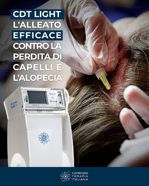 🌟 Carbossiterapia: un prezioso alleato per la salute dei capelli 🌟La carbossiterapia è un trattamento medico che utilizza l'iniezione di anidride carbonica sterile nel cuoio capelluto, con effetti straordinari su tutto il sistema vascolare e sui follicoli piliferi. 💆♂️✨Grazie alla CO2, vengono stimolati:✅ Vasodilatazione arteriosa: più ossigeno per i follicoli piliferi.✅ Metabolismo cellulare: bulbi più vitali e attivi.✅ Microcircolazione capillare: apporto di nutrienti essenziali per la crescita dei capelli.✅ Attività cellulare della pelle: maggiore elasticità cutanea.✅ Drenaggio venoso e linfatico: eliminazione delle tossine.👉 Risultati? Capelli più folti, forti e sani, con una riduzione della caduta e un miglioramento visibile anche nelle zone più diradate, come la linea frontale e i golfi temporali.💡 Scopri di più sul nostro sito web: i capelli dei tuoi pazienti (e non solo) ti ringrazieranno! 🌱#CarbossiterapiaItaliana#Carbossiterapia #CDTEvolution #CapelliSani #BenessereCapelli #TrattamentiMedici