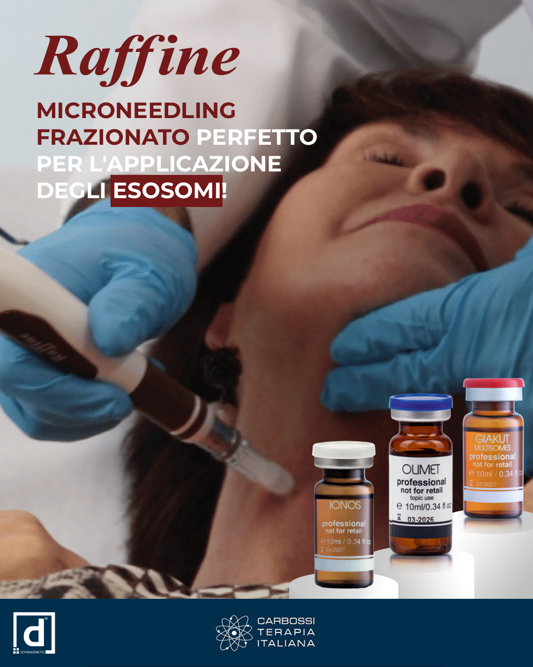 ✨ Raffine: tecnologia e innovazione per la bellezza della pelle ✨Progettato per i professionisti più esigenti, Raffine è il dispositivo di microneedling avanzato che trasforma ogni trattamento in un’esperienza di rigenerazione profonda.Con la sua tecnologia di precisione:🔹 Affina la grana della pelle🔹 Riduce visibilmente rughe e cicatrici🔹 Stimola un ringiovanimento globale💡 Vuoi fare un passo oltre? Abbina gli esosomi.L’unione tra microneedling ed esosomi amplifica i risultati grazie all’azione mirata di questi potenti veicolatori biologici:✔️ Attivano la sintesi di collagene ed elastina✔️ Favoriscono la riparazione cellulare✔️ Calmano l’infiammazione e accelerano i tempi di recupero💎 Il risultato? Una pelle più compatta, luminosa e giovane, già dopo poche sedute.👉 Scopri tutti i dettagli su carbossiterapia.it🌐#MicroneedlingProfessionale #Esosomi #RigenerazioneCutanea #CarbossiterapiaItaliana #DermatologiaAvanzata