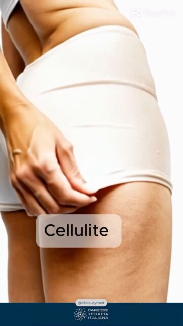 ✨ Un ringraziamento speciale a @elbeautymed per aver scelto CDT Light per il loro studio medico! 💎Siamo orgogliosi di supportare professionisti che ogni giorno mettono al centro la sicurezza, l’innovazione e i risultati reali per i propri pazienti.Con CDT Light, la carbossiterapia diventa ancora più precisa, confortevole ed efficace. 💨#Carbossiterapia #CDTLight #CarbossiterapiaItaliana #MedicinaEstetica #ElBeautyMed #InnovazioneMedica #MadeInItaly