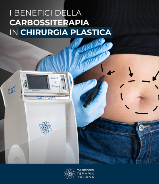 La carbossiterapia è un ottimo complemento nella preparazione e nel post-operatorio per interventi come la liposuzione, lipoaspirazione e l’addominoplastica.Questo trattamento, che prevede la somministrazione di anidride carbonica medicale nel tessuto sottocutaneo, consente un miglioramento del risultato finale e una diminuzione dei tempi di recupero post-intervento.I medici che integrano la carbossiterapia nel protocollo pre e post operatorio possono offrire ai pazienti un miglior percorso di cura, grazie all'azione della carbossiterapia e alle sue proprietà lipolitiche, che permette un miglioramento dell'irregolarità e dell'elasticità cutanea. In sintesi, la carbossiterapia rappresenta un approccio clinico efficace per ottimizzare gli esiti chirurgici e migliorare la soddisfazione dei pazienti.Scopri di più sulle tanti applicazioni d’uso della carbossiterapia nel nostro sito web 👉 https://carbossiterapia.it/applicazioni-e-soluzioni/#CarbossiterapiaItaliana