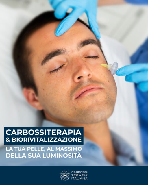 ✨ Esalta la tua bellezza con la Carbossiterapia e la Biorivitalizzazione! ✨La combinazione di carbossiterapia e biorivitalizzazione è la formula vincente per risultati più efficaci e duraturi! 💎🔬 Perché scegliere la biorivitalizzazione?Non è un semplice "filler", ma una vera e propria stimolazione naturale del processo di rinnovamento cellulare. Grazie a una formula ricca di:✔️ Polinucleotidi✔️ Aminoacidi✔️ Vitamine e minerali✔️ Antiossidanti✔️ Acido IaluronicoQuesta tecnica migliora il livello di idratazione, l'elasticità e il tono della pelle, donandole un aspetto luminoso e fresco. 🌟💡 Associata alla carbossiterapia, i risultati sono amplificati, rendendo il trattamento un alleato perfetto per contrastare i segni dell'invecchiamento e migliorare la qualità della pelle.Se desideri saperne di più o scoprire come questo trattamento può aiutarti, visita il nostro sito web carbossiterapia.it!#CarbossiterapiaItaliana#Carbossiterapia #Biorivitalizzazione #BellezzaNaturale #CuraDellaPelleProfessionale