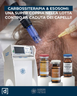 La medicina rigenerativa è in continua evoluzione e i risultati più avanzati non derivano più da un singolo trattamento, ma da combinazioni intelligenti.

Integrando la carbossiterapia con la terapia a base di esosomi, sblocchiamo un approccio sinergico e potente per il ripristino dei capelli.

La carbossiterapia agisce rilasciando CO₂ medicale nel cuoio capelluto, stimolando la microcircolazione e aumentando il rilascio di ossigeno a livello tissutale. Questo crea un ambiente biologico ottimale, riattivando i follicoli dormienti e migliorando l'apporto di nutrienti.

Gli esosomi, d'altro canto, agiscono come messaggeri cellulari. Ricchi di fattori di crescita, peptidi e molecole di segnalazione, agiscono sul follicolo a livello molecolare, promuovendo la rigenerazione, prolungando la fase anagen e migliorando la densità e la qualità dei capelli.

Perché combinarli?

Perché una migliore circolazione significa un migliore apporto di nutrienti.
Perché un cuoio capelluto stimolato risponde meglio ai segnali rigenerativi.
Perché la sinergia amplifica i risultati.

Il risultato non è solo una riduzione della caduta dei capelli, ma capelli visibilmente più forti, spessi e sani nel tempo.

Basato sulla scienza. Minimamente invasivo. Straordinariamente efficace.

#Bellezza #Carbossiterapia #Esosomi #Trattamenti #PellePerfetta #Luminosità #CuraDellaPelle