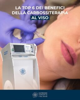 I 6 principali benefici della Carbossiterapia Viso
✅ Elimina le occhiaie e le borse sotto gli occhi 
La CO₂ migliora il microcircolo perioculare, riducendo il colorito scuro delle occhiaie e il gonfiore.

✅ Riduce rughe e linee sottili 
La stimolazione del collagene leviga la pelle e attenua i segni dell’invecchiamento.

✅ Migliora il tono e la compattezza della pelle 
La pelle appare più soda e luminosa, con un effetto lifting naturale.

✅ Ossigena i tessuti e dona luminosità 
Perfetto per chi ha la pelle spenta e poco uniforme, il trattamento dona un colorito più sano e radioso.

✅ Non invasivo, sicuro e senza tempi di recupero 
Il trattamento è veloce, senza anestesia e senza effetti collaterali rilevanti.

✅ Stimola la rigenerazione cellulare 
Migliora l’elasticità della pelle e la rende più resistente agli agenti esterni.

Scopri di più sulle tanti applicazioni d’uso della carbossiterapia nel nostro sito web 👉 https://carbossiterapia.it/applicazioni-e-soluzioni/
#CarbossiterapiaItaliana
#Carbossiterapia #BellezzaGambe #Benessere #TrattamentiEstetici