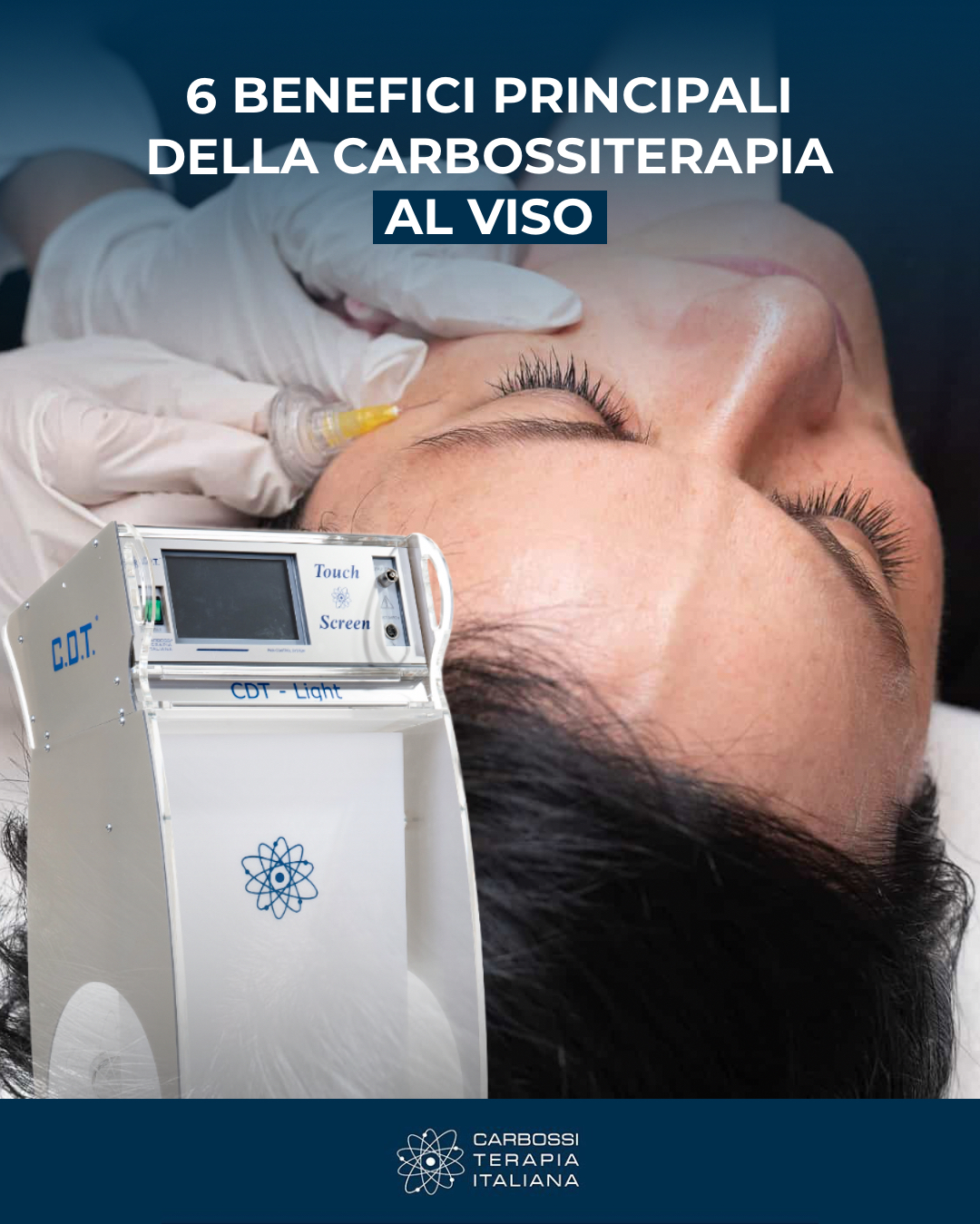 I 6 principali benefici della Carbossiterapia Viso
✅ Elimina le occhiaie e le borse sotto gli occhi
La CO₂ migliora il microcircolo perioculare, riducendo il colorito scuro delle occhiaie e il gonfiore.
✅ Riduce rughe e linee sottili
La stimolazione del collagene leviga la pelle e attenua i segni dell’invecchiamento.
✅ Migliora il tono e la compattezza della pelle
La pelle appare più soda e luminosa, con un effetto lifting naturale.
✅ Ossigena i tessuti e dona luminosità
Perfetto per chi ha la pelle spenta e poco uniforme, il trattamento dona un colorito più sano e radioso.
✅ Non invasivo, sicuro e senza tempi di recupero
Il trattamento è veloce, senza anestesia e senza effetti collaterali rilevanti.
✅ Stimola la rigenerazione cellulare
Migliora l’elasticità della pelle e la rende più resistente agli agenti esterni.
Scopri di più sulle tanti applicazioni d’uso della carbossiterapia nel nostro sito web 👉 https://carbossiterapia.it/applicazioni-e-soluzioni/
#CarbossiterapiaItaliana
#Carbossiterapia #BellezzaGambe #Benessere #TrattamentiEstetici